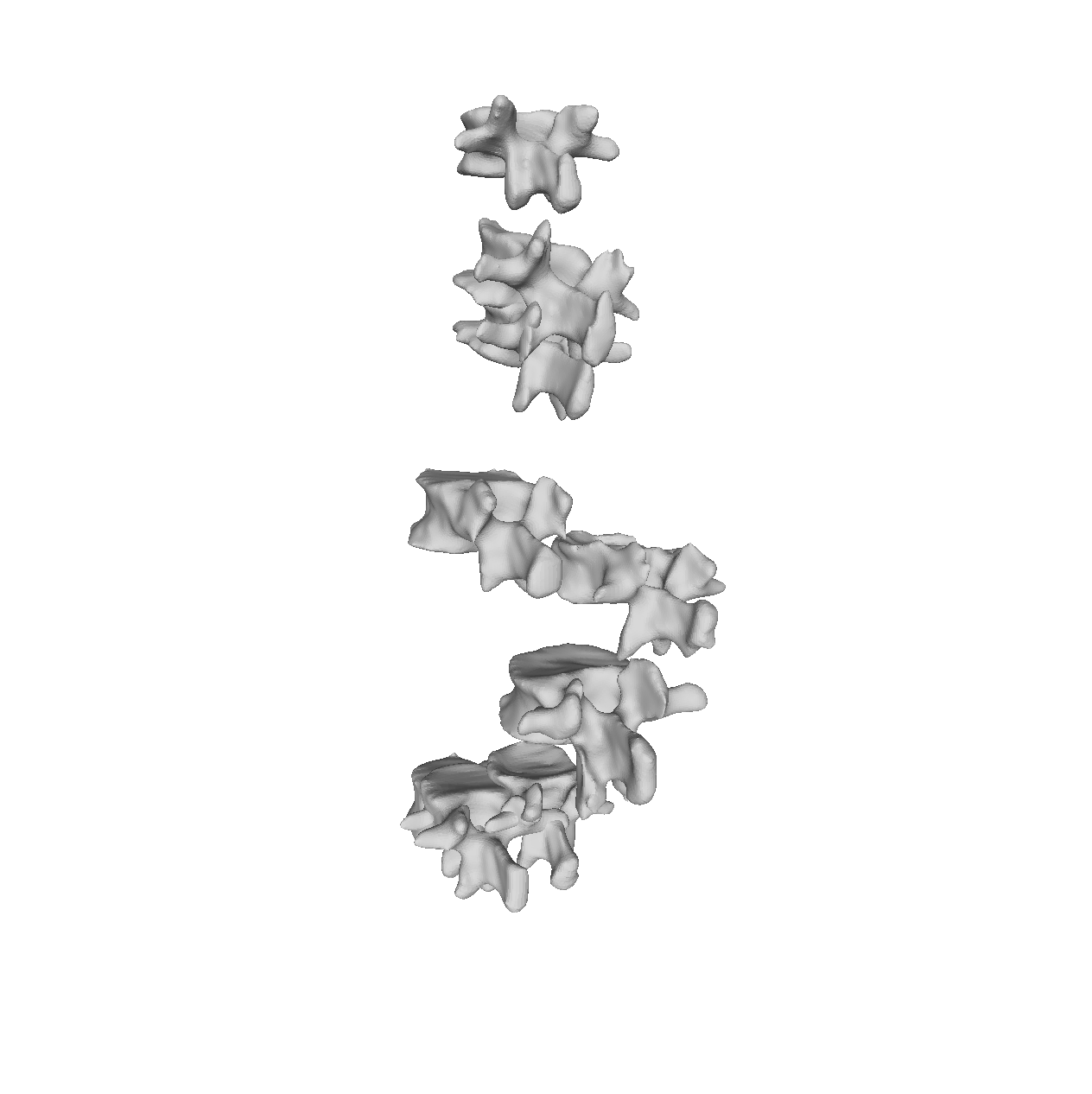 Vertebrae Dataset raw