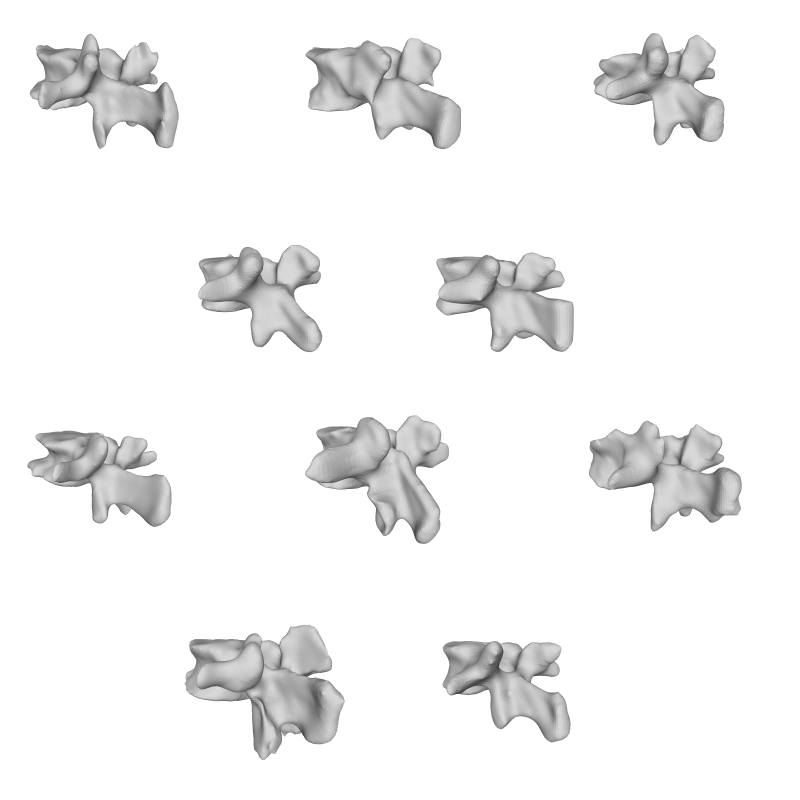 Vertebrae Dataset