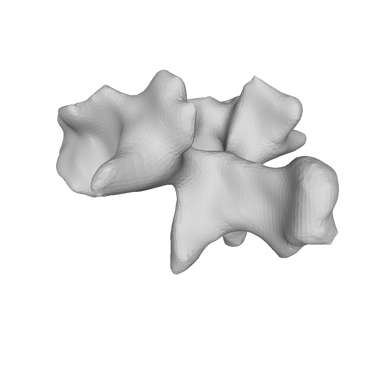 Vertebrae noisy segmented